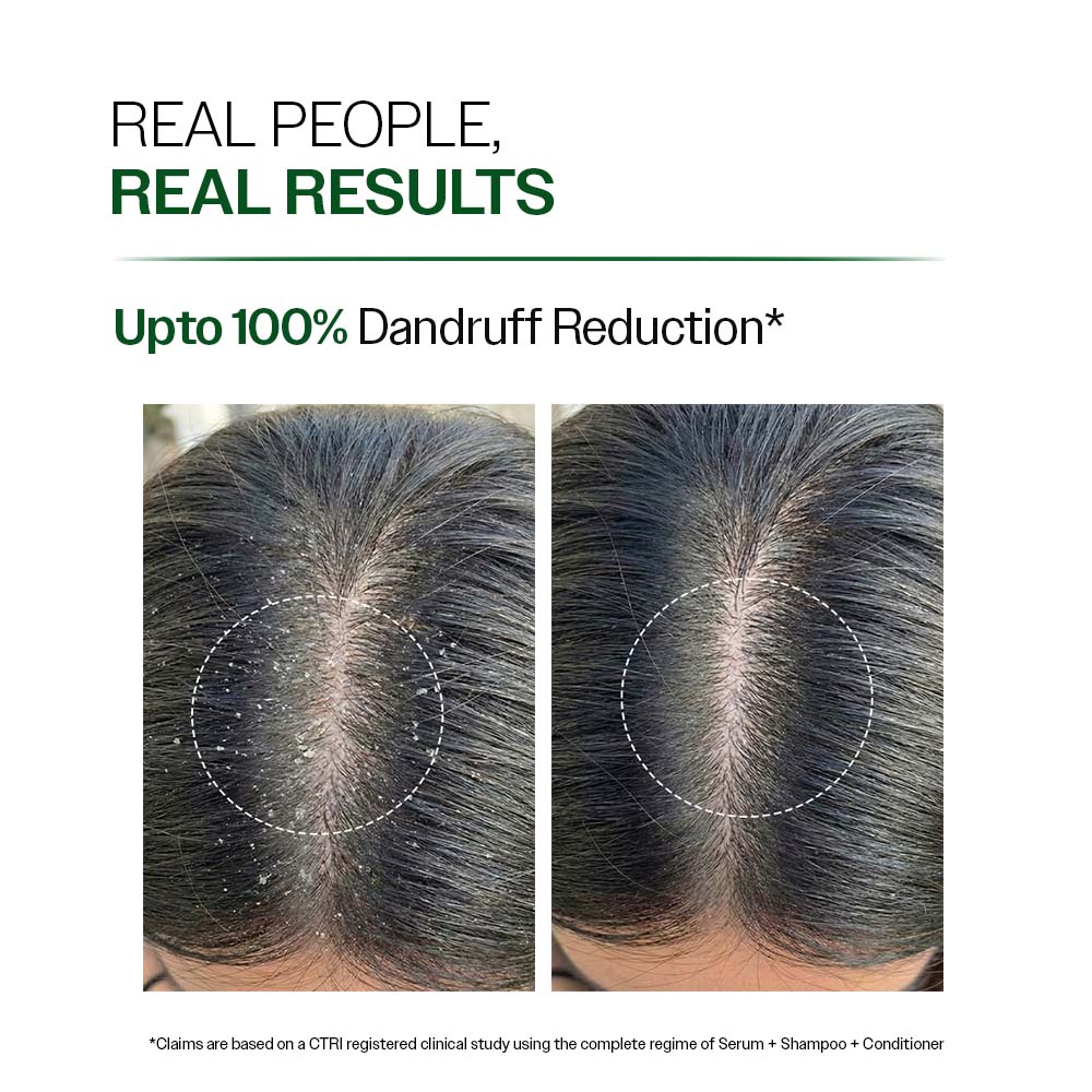 Bare Anatomy Expert Anti-Dandruff Shampoo | 250 ml