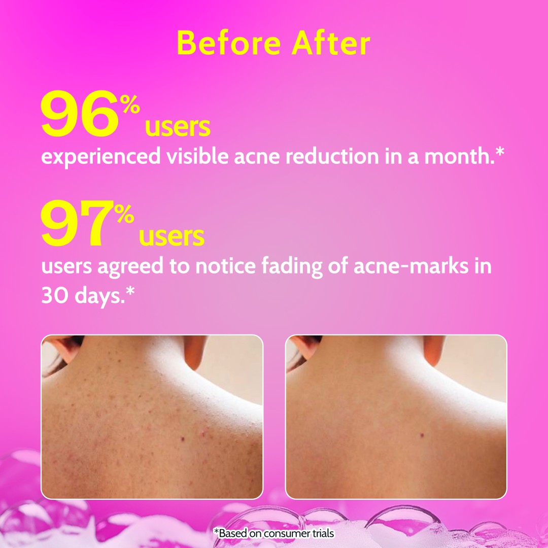 1% Salicylic Acid Body Wash for Acne Control - 236 ml