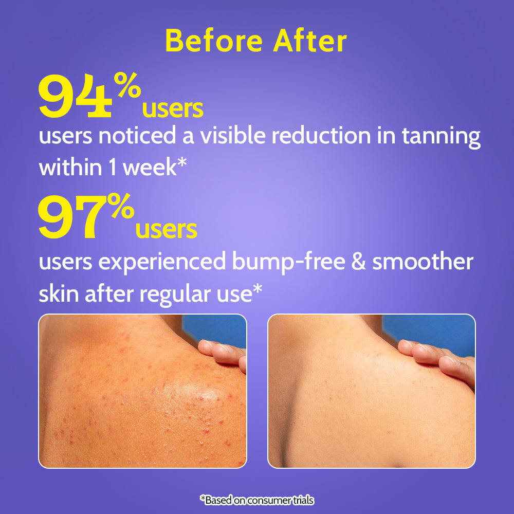 Exfoliating Body Wash with Lactic Acid & Salicylic Acid - 473 ml