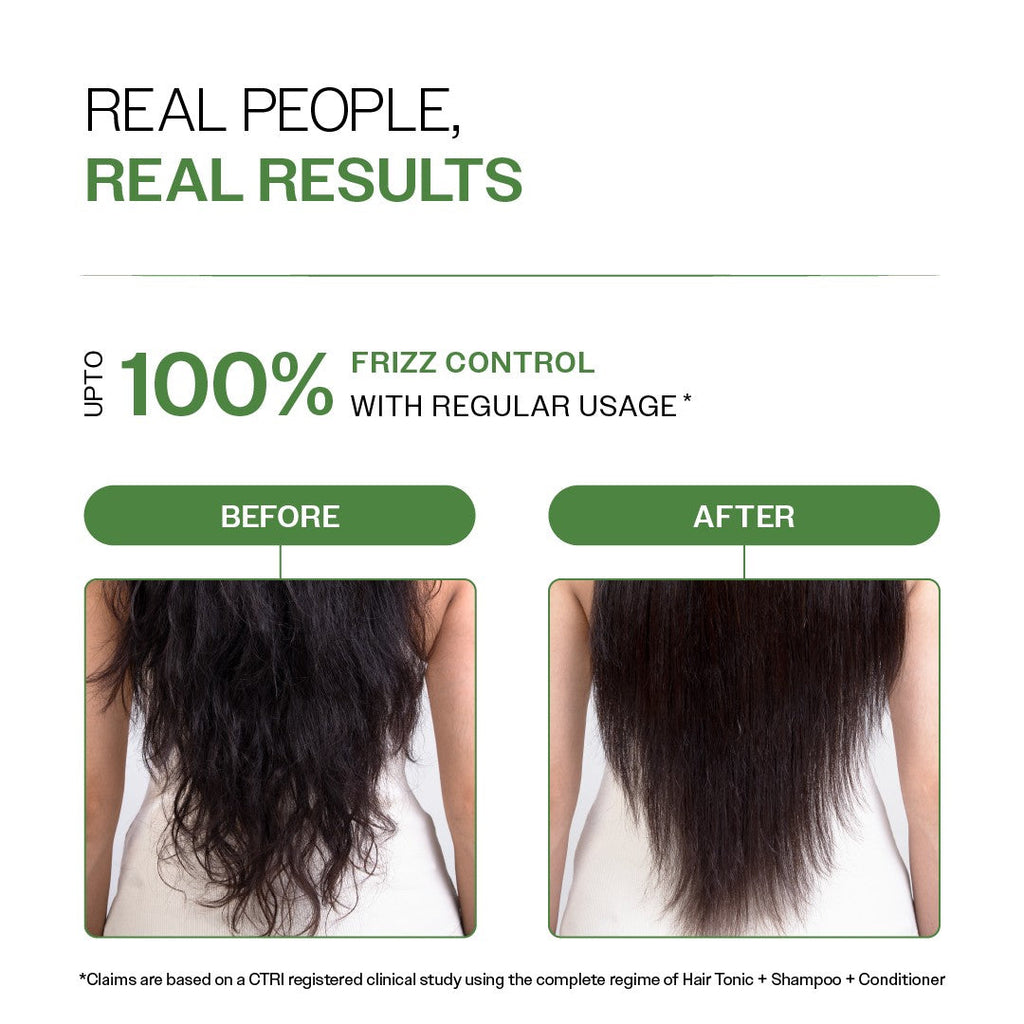 Anti-Dandruff Hair Conditioner with Biotin, Salicylic Acid & Rosemary