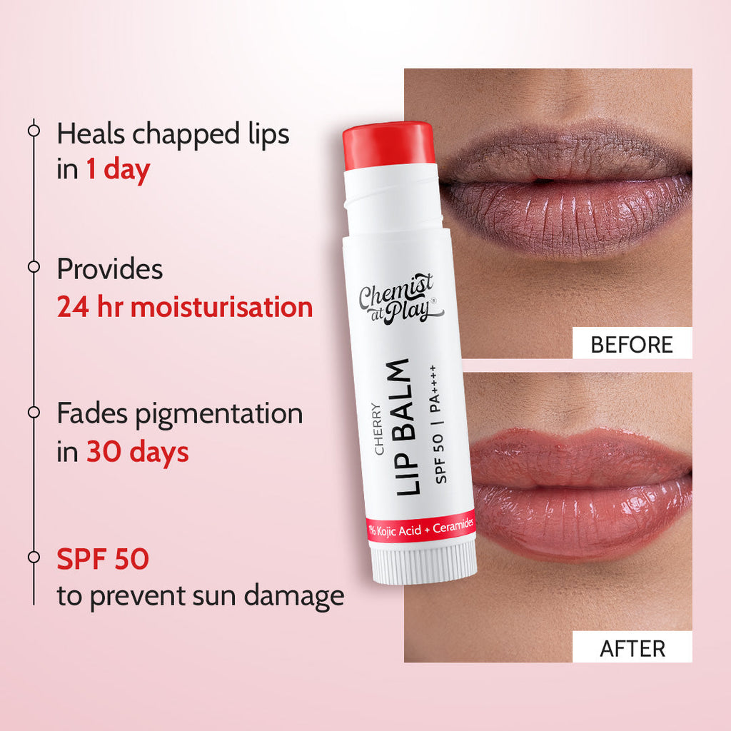 Cherry Lip Balm for Chapped & Pigmented Lips | SPF 50 PA++++ & Kojic Acid | 4.5 gm