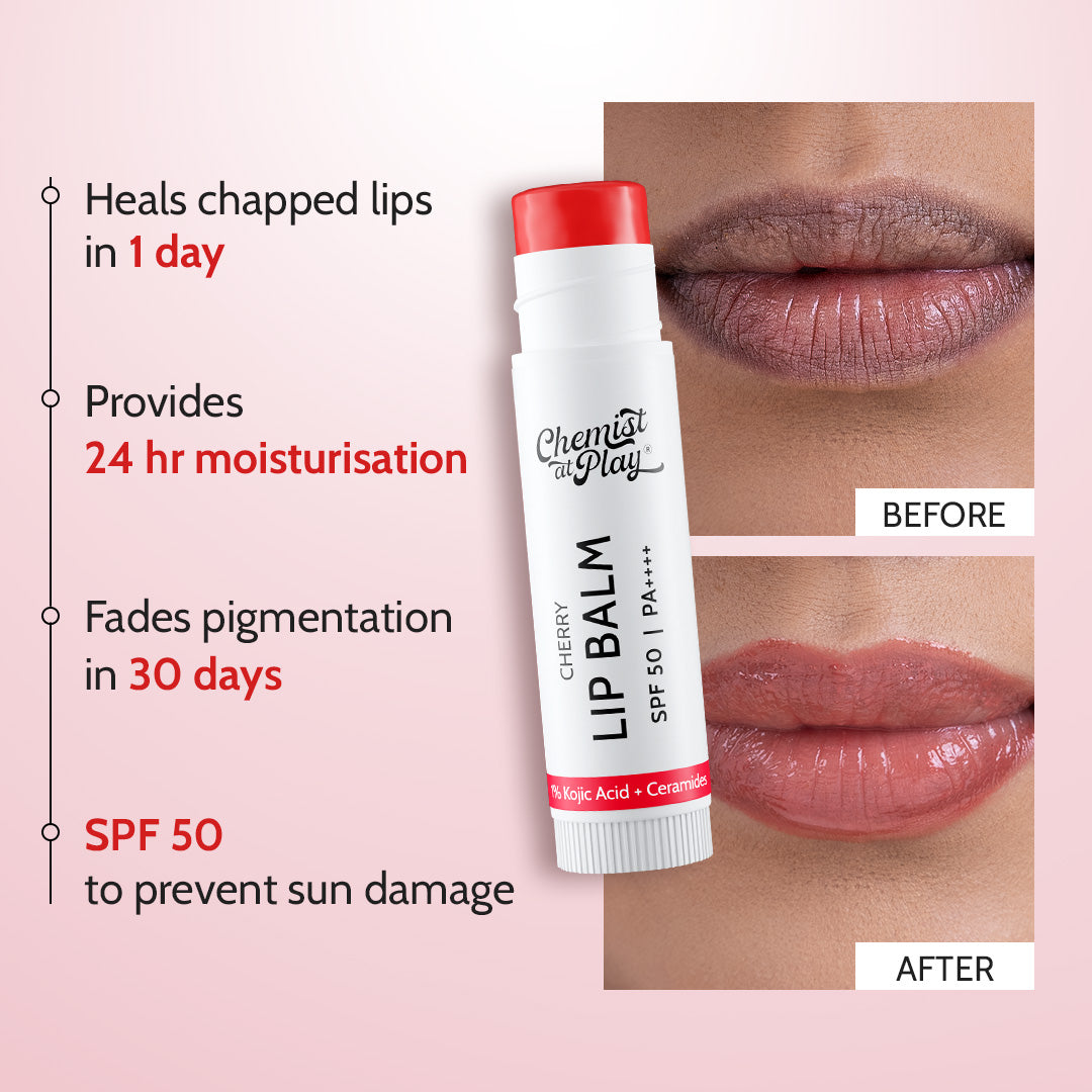 Cherry Lip Balm for Chapped & Pigmented Lips | SPF 50 PA++++ & Kojic Acid | 4.5 gm