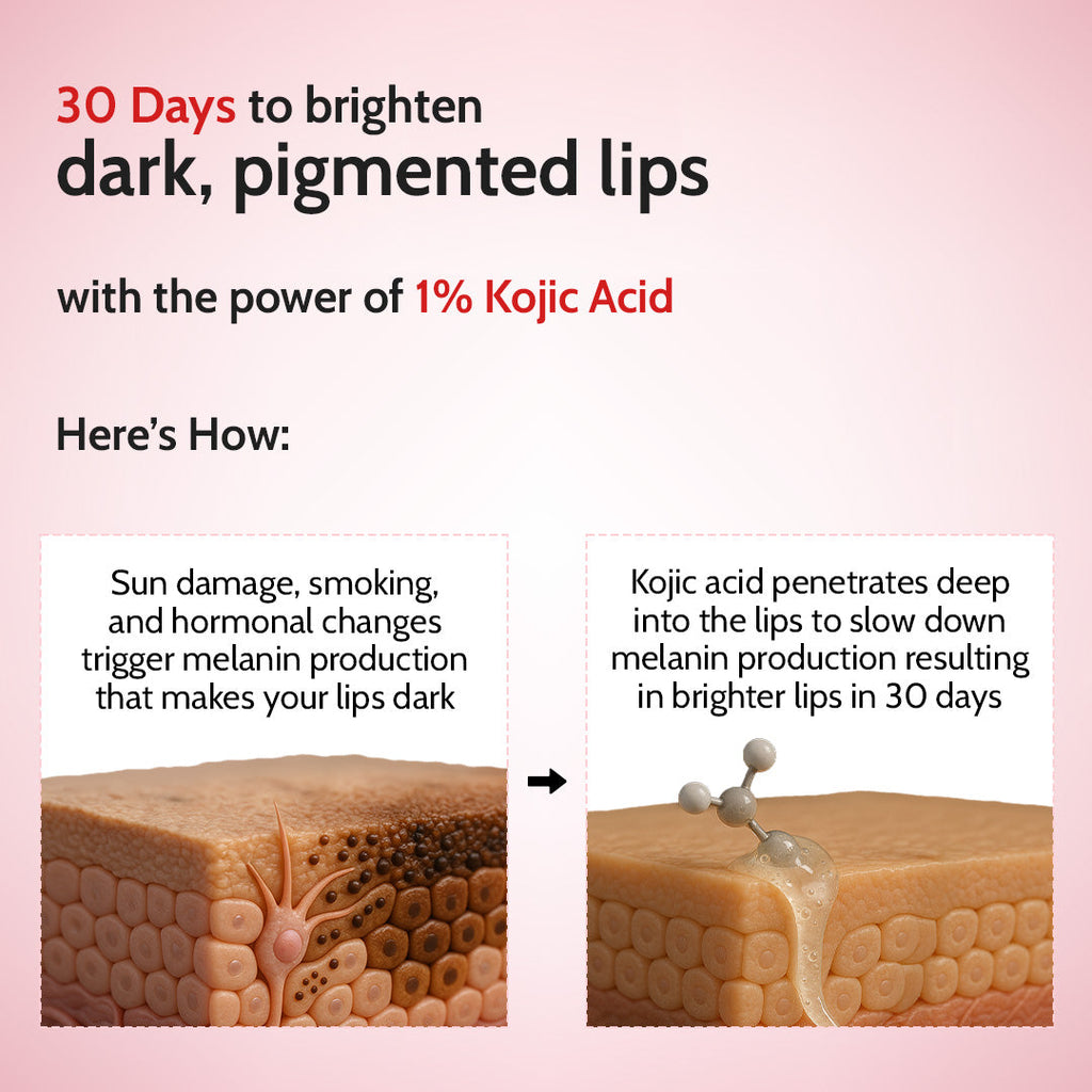 Cherry Lip Balm for Chapped & Pigmented Lips | SPF 50 PA++++ & Kojic Acid | 4.5 gm