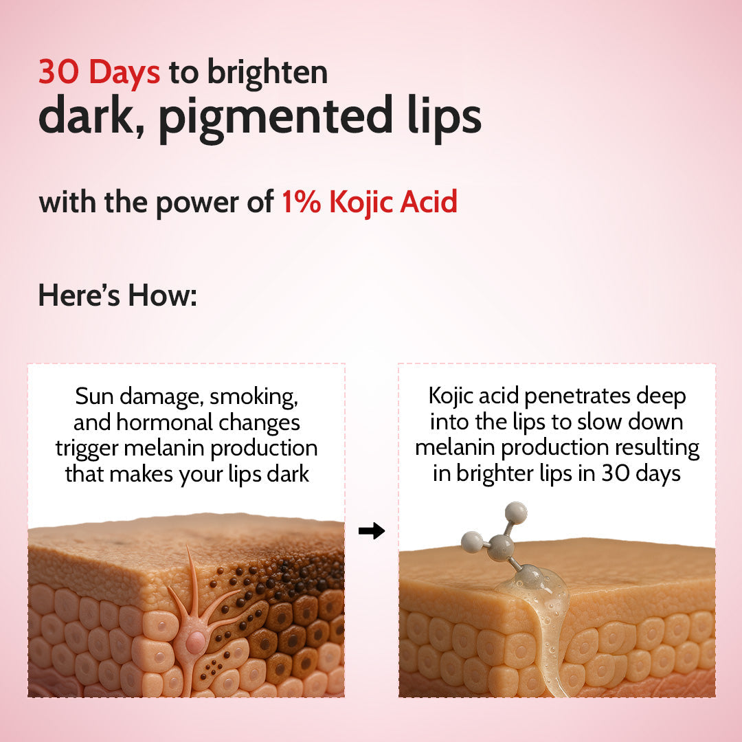 Cherry Lip Balm for Chapped & Pigmented Lips | SPF 50 PA++++ & Kojic Acid | 4.5 gm